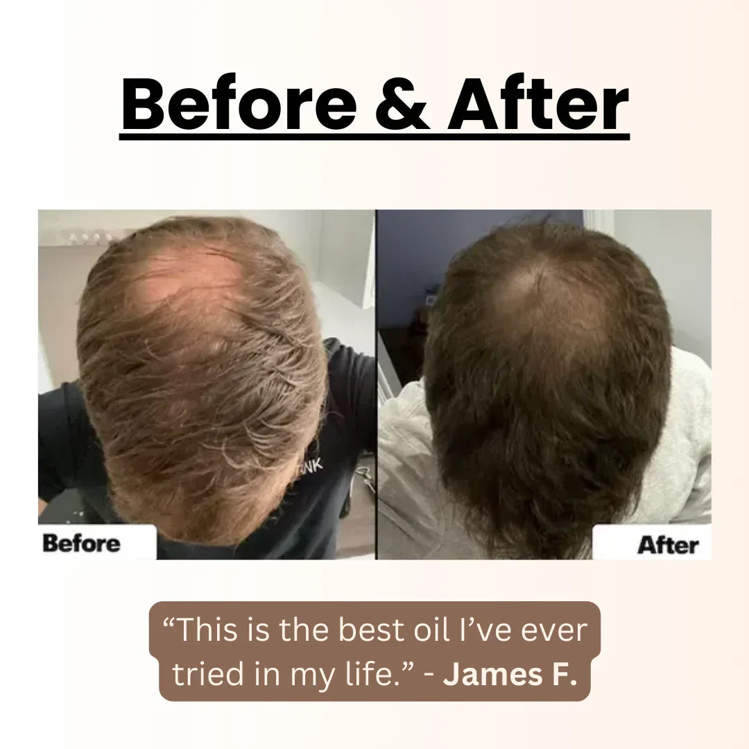 Rå Batana - Olje for hårvekst