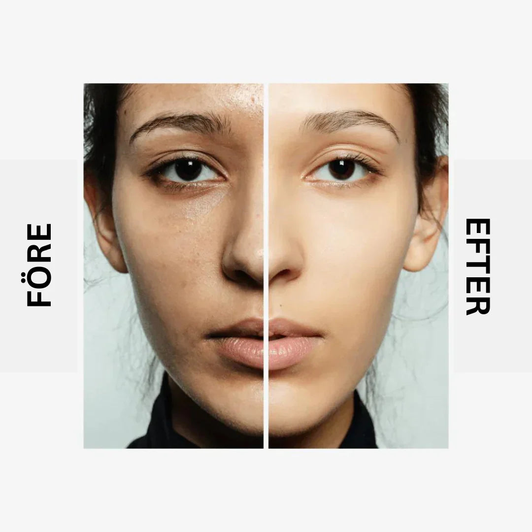 Alvobutik™ Ansiktsvask med gurkemeie for glød, urenheter og akne