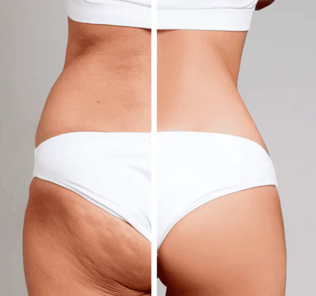 Verktøy for Guasha-massasje