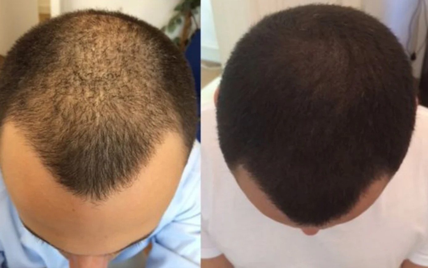 ROOT ACTIVATOR SHAMPOO | STIMULERER HÅRVEKSTEN