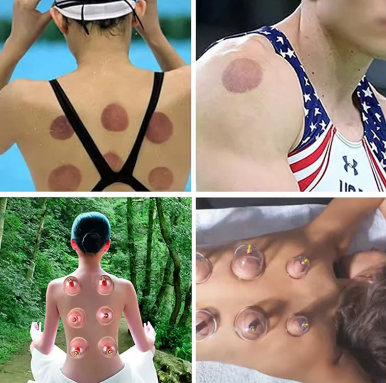 Set med 12 massagekoppar - lindrar muskel och ledvärk