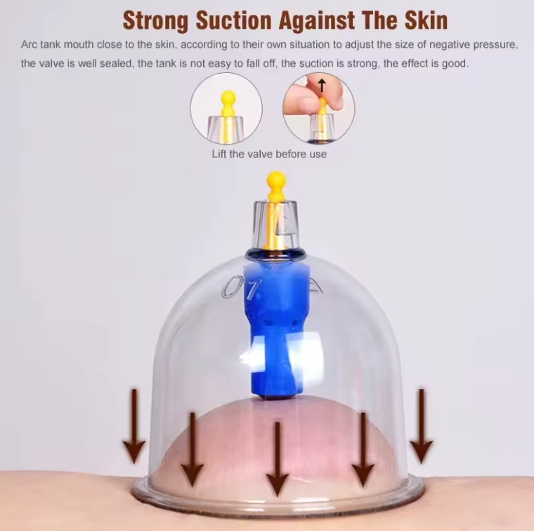 Set med 12 massagekoppar - lindrar muskel och ledvärk