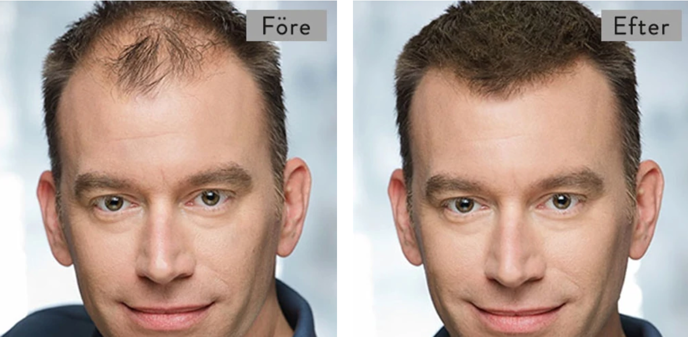 Toppik Hair Thickening - För tjockare, friskare hår på ett ögonblick!