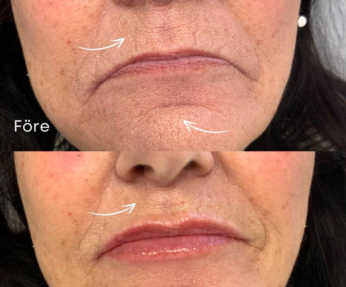 Din komplette hudpleierutine i én flaske - 24K Anti-Aging Gold