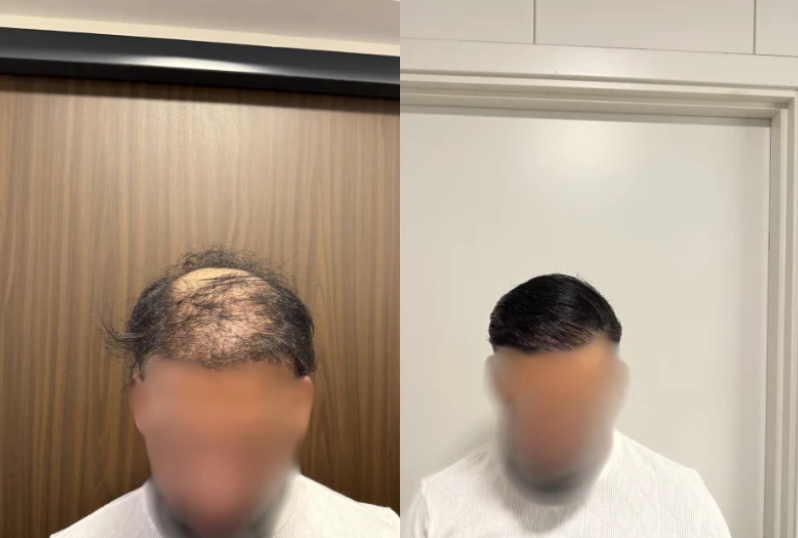 HairMagic™ - Magicolour per capelli densi e pieni di sicurezza