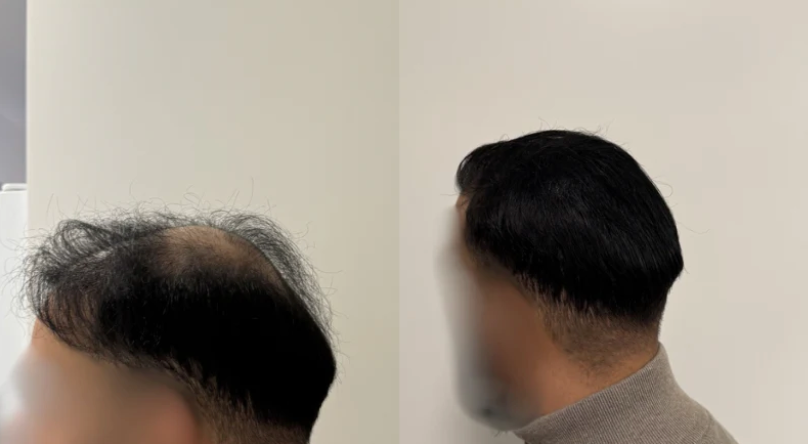 HairMagic™ - Magicolour per capelli densi e pieni di sicurezza