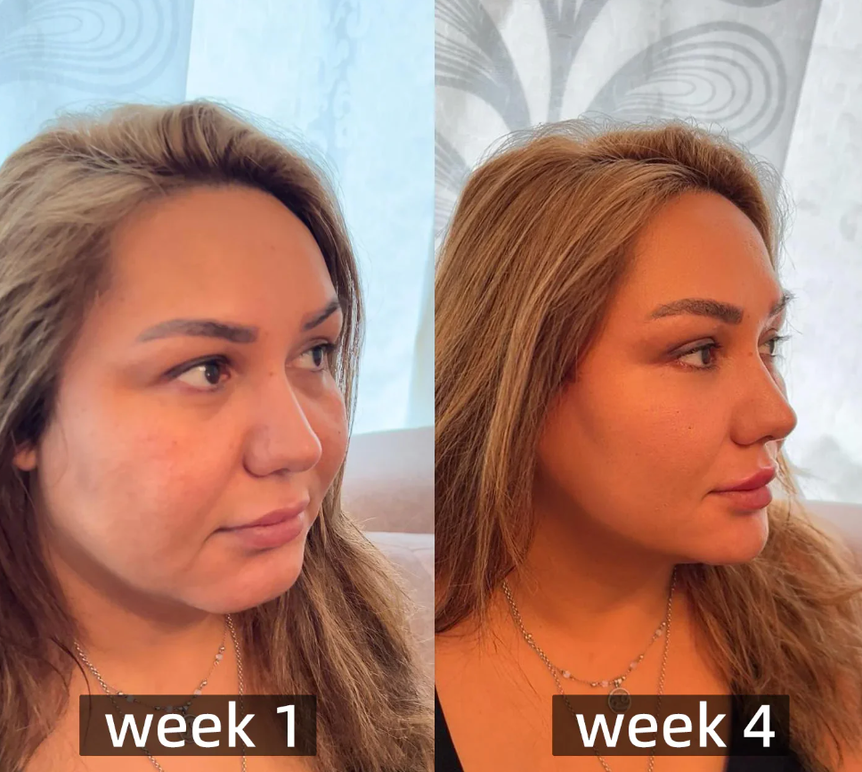 Slim™ | Forbrenn 2 kg overflødig fett på bare 3 dager!