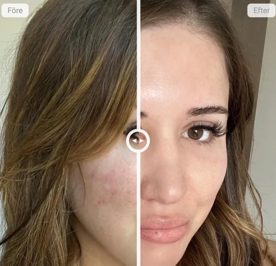 Djup Bio-Kollagenmask | Avancerad kollagenvård för fastare och strålande hy på endast 7 dagar