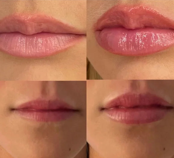 LushLips – Zachte, volle lippen zonder gedoe.