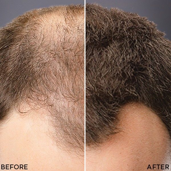 Toppik Hair Thickening - Per capelli più folti e sani in un istante!